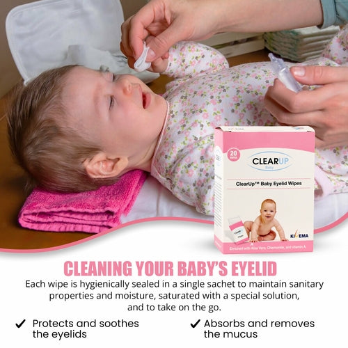 Baby Eyelid Wipes — Soothing Eye Care (Pack of 20)