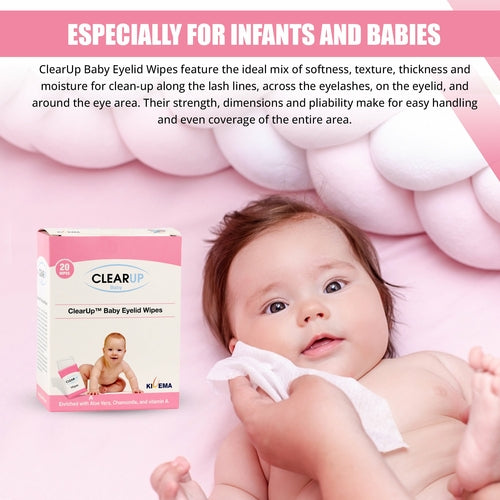 Baby Eyelid Wipes — Soothing Eye Care (Pack of 20)