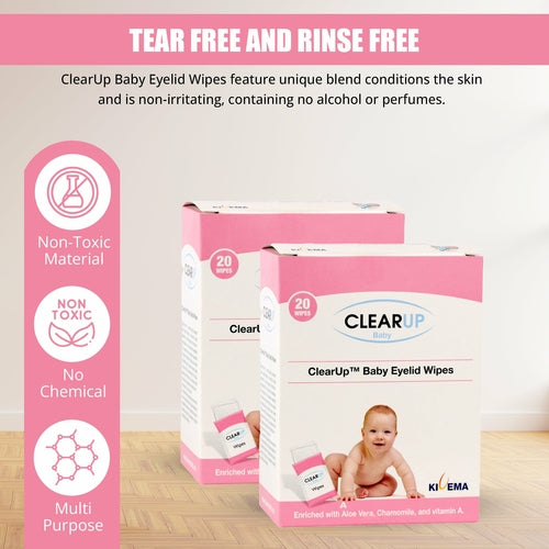 Baby Eyelid Wipes — Soothing Eye Care (Pack of 20)